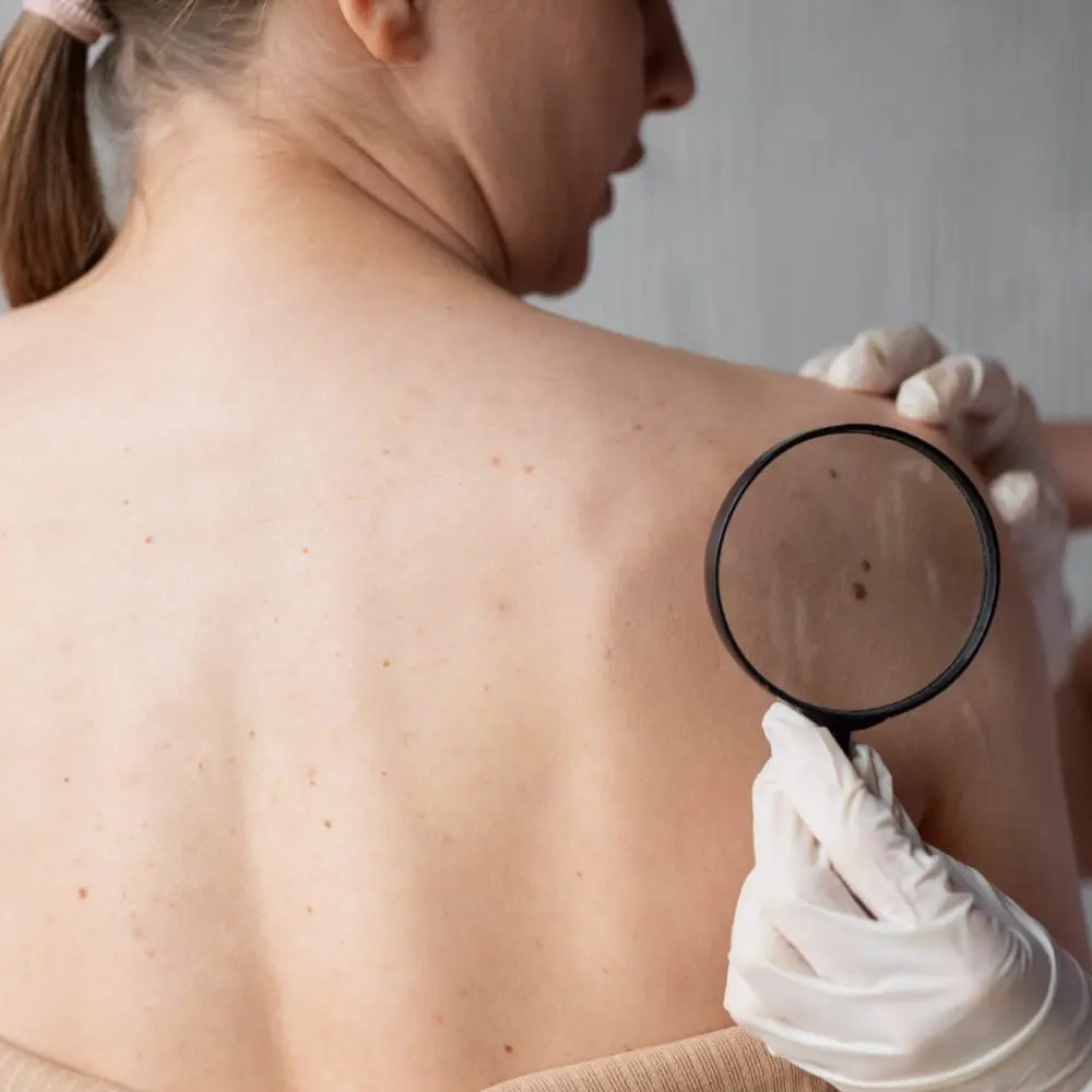 Skin Conditions, Dermatology